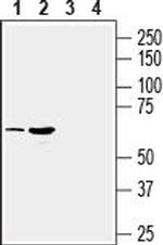 SLC17A9 Antibody in Western Blot (WB)