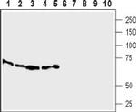 SLC7A2 (extracellular) Antibody in Western Blot (WB)