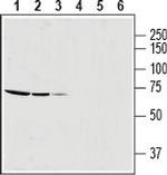 SLC25A12 Antibody in Western Blot (WB)