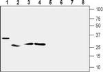 UCP2 Antibody in Western Blot (WB)