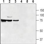 SLC47A1 Antibody in Western Blot (WB)