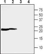 MMGT1 Antibody in Western Blot (WB)