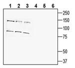 SLC38A9 Antibody in Western Blot (WB)