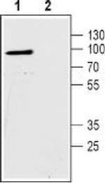 Na+/H+ Exchanger 2 (NHE-2) Antibody in Western Blot (WB)