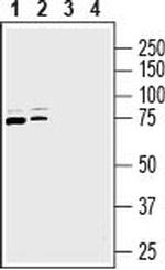 Na+/H+ Exchanger 6 (NHE-6) Antibody in Western Blot (WB)