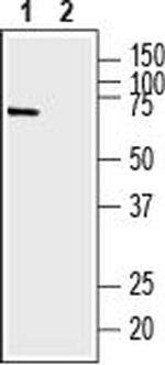 Na+/H+ Exchanger 6 (NHE-6) Antibody in Western Blot (WB)