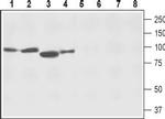 NCX2 (SLC8A2) Antibody in Western Blot (WB)