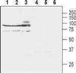 NCX3 (SLC8A3) Antibody in Western Blot (WB)