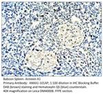 Annexin A1 Antibody in Immunohistochemistry (IHC)