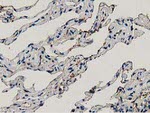 ANXA3 Antibody in Immunohistochemistry (Paraffin) (IHC (P))