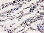 ANXA3 Antibody in Immunohistochemistry (Paraffin) (IHC (P))