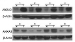 ANXA3 Antibody in Western Blot (WB)