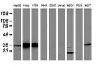 ANXA3 Antibody in Western Blot (WB)