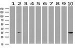 ANXA3 Antibody in Western Blot (WB)