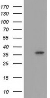 ANXA3 Antibody in Western Blot (WB)