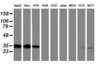 ANXA3 Antibody in Western Blot (WB)