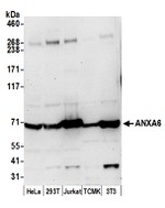 ANXA6 Antibody in Western Blot (WB)