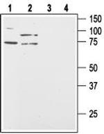 Orexin Receptor 2 Antibody in Western Blot (WB)