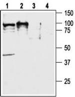 Orexin Receptor 2 Antibody in Western Blot (WB)