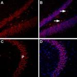 Nociceptin Receptor (OPRL1) Antibody in Immunohistochemistry (IHC)