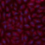 alpha Adaptin Antibody in Immunocytochemistry (ICC/IF)