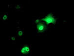 AP2M1 Antibody in Immunocytochemistry (ICC/IF)