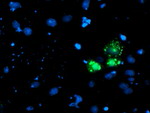 AP2M1 Antibody in Immunocytochemistry (ICC/IF)