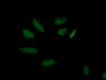 AP2M1 Antibody in Immunocytochemistry (ICC/IF)