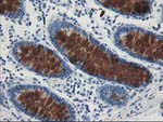 AP2M1 Antibody in Immunohistochemistry (Paraffin) (IHC (P))