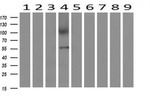 AP2M1 Antibody in Western Blot (WB)