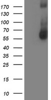 AP2M1 Antibody in Western Blot (WB)