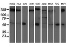 AP2M1 Antibody in Western Blot (WB)