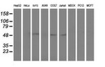 AP2M1 Antibody in Western Blot (WB)