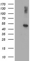 AP2M1 Antibody in Western Blot (WB)