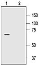 KV1.2 (KCNA2) Antibody in Western Blot (WB)