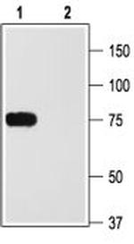 KV1.2 (KCNA2) Antibody in Western Blot (WB)