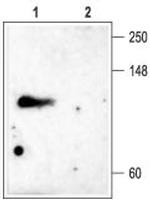 KCNC4 (KV3.4) Antibody in Western Blot (WB)