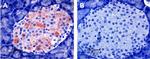 Kir6.2 Antibody in Immunohistochemistry (IHC)