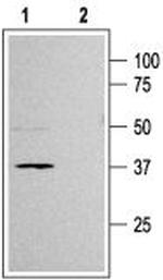 Kir6.2 Antibody in Western Blot (WB)