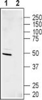 Kir6.2 Antibody in Western Blot (WB)