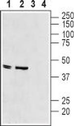 Kir6.2 Antibody in Western Blot (WB)