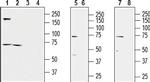 KCNQ1 Antibody in Western Blot (WB)