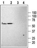 KCNK3 (TASK-1) Antibody in Western Blot (WB)