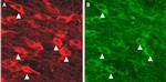 KCNN3 (KCa2.3, SK3) Antibody in Immunohistochemistry (IHC)