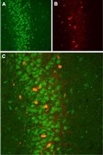 slo beta 2 (KCNMB2) Antibody in Immunohistochemistry (IHC)