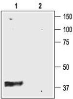 Kir4.1 (KCNJ10) Antibody in Western Blot (WB)