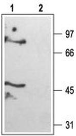 KCNK6 (TWIK-2) Antibody in Western Blot (WB)