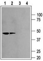 Kir2.2 (KCNJ12) Antibody in Western Blot (WB)