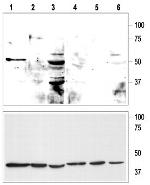 KCNK9 (TASK-3) (extracellular) Antibody in Western Blot (WB)