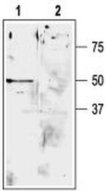 KCNK9 (TASK-3) (extracellular) Antibody in Western Blot (WB)